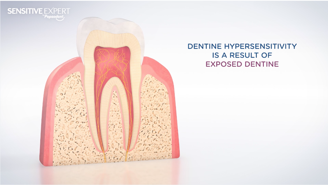 Pepsodent MOA